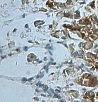 ZMYND19 Rabbit Polyclonal Antibody