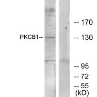 ZMYND8 Antibody