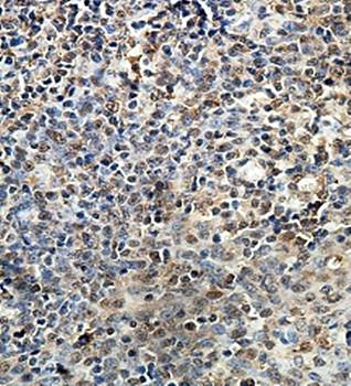 ZNF276 Rabbit Polyclonal Antibody