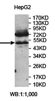 ZNF562 Rabbit Polyclonal Antibody