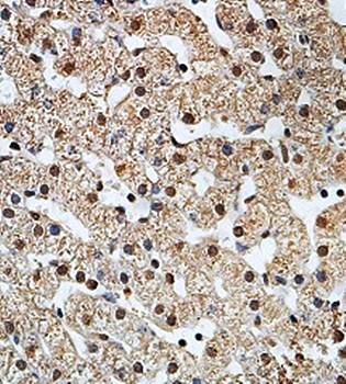 ZNF562 Rabbit Polyclonal Antibody