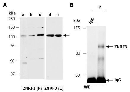 Rabbit polyclonal antibody to ZNRF3 (Paired)