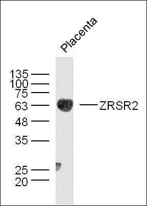 ZRSR2 Rabbit Polyclonal Antibody