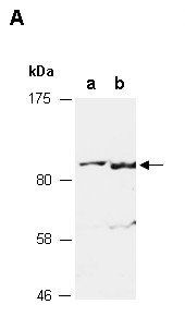 ZSCAN10 (C) Antibody, Rabbit Polyclonal