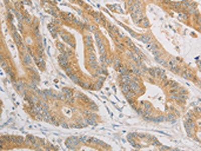 ZWINT Antibody