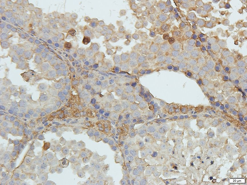 Zyxin Rabbit Polyclonal Antibody