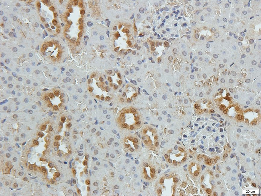 Zyxin Rabbit Polyclonal Antibody