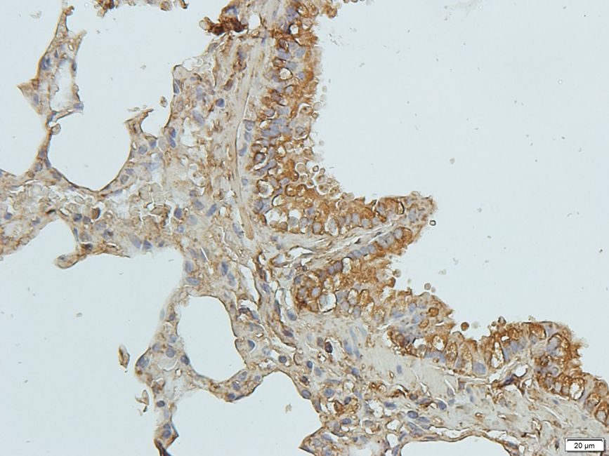 Zyxin Rabbit Polyclonal Antibody