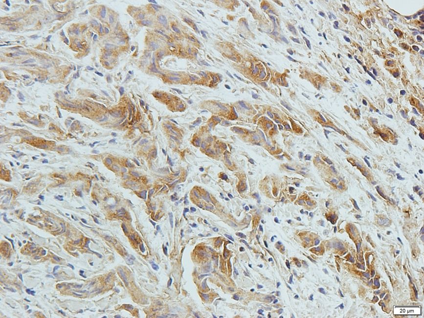 Zyxin Rabbit Polyclonal Antibody