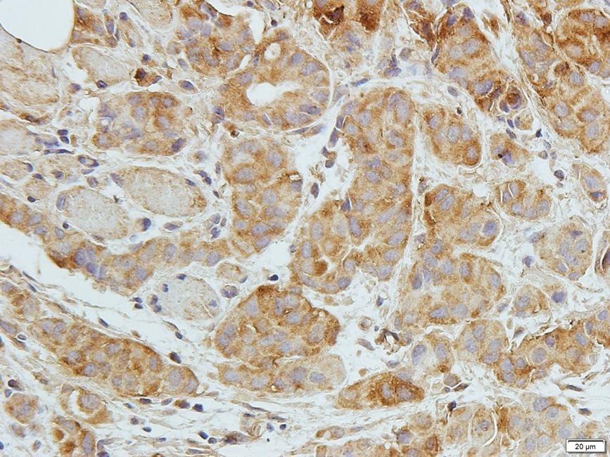 Zyxin Rabbit Polyclonal Antibody