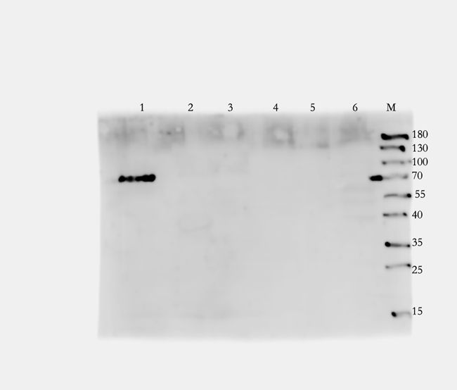 Zyxin Rabbit Polyclonal Antibody