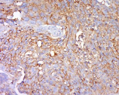 Phospho-Zyxin (Ser142+Ser143) Rabbit Polyclonal Antibody