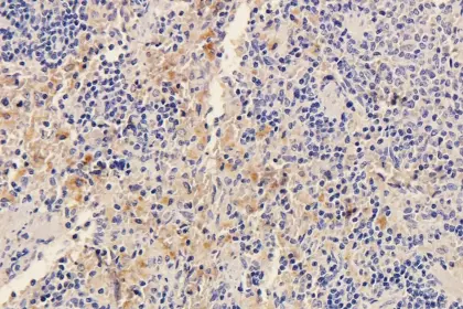 SOX2 antibody