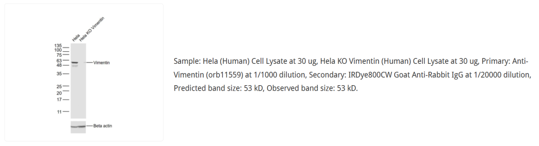 orb11559 Western Blot：Hela 与 Hela Vimentin 敲除细胞